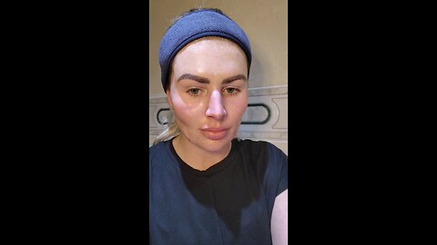 Easy Dermal Stamping