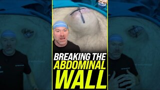 Breaking the Abdominal Wall 😱 #shorts