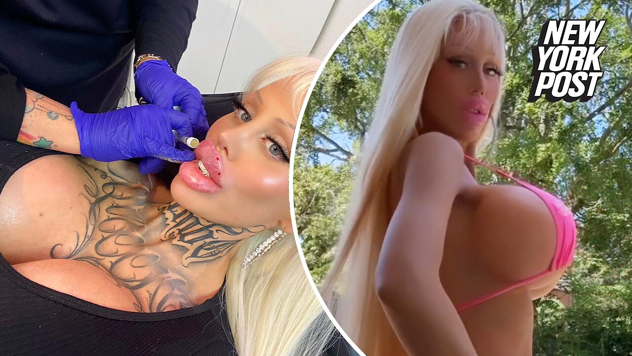 Woman who spent $200,000 to become Barbie 'removes' tattoos so she could be more plastic looking