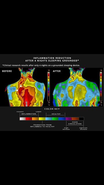 Clint Ober, Grounding For Health