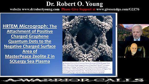 Horrific Evidence Graphene Oxide in all of us captured ONLY by MasterPeace
