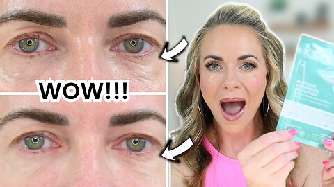 MICRONEEDLING EYE PATCHES: Unveiling Less Wrinkles Under Eyes