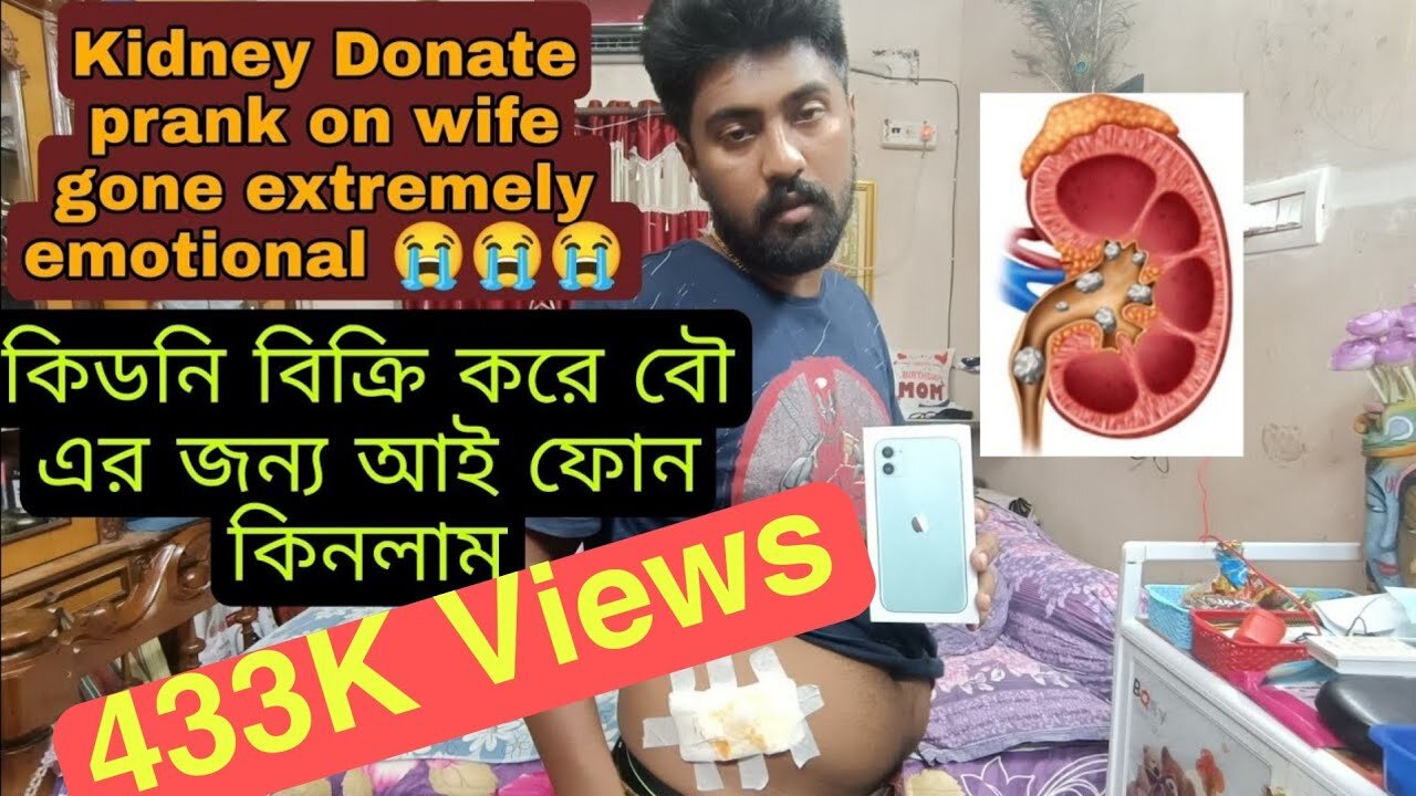 Kidney donet prank on wife gone extremely wrong 😱