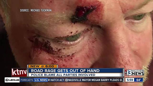 Road rage rock-throwing injures Las Vegas Man