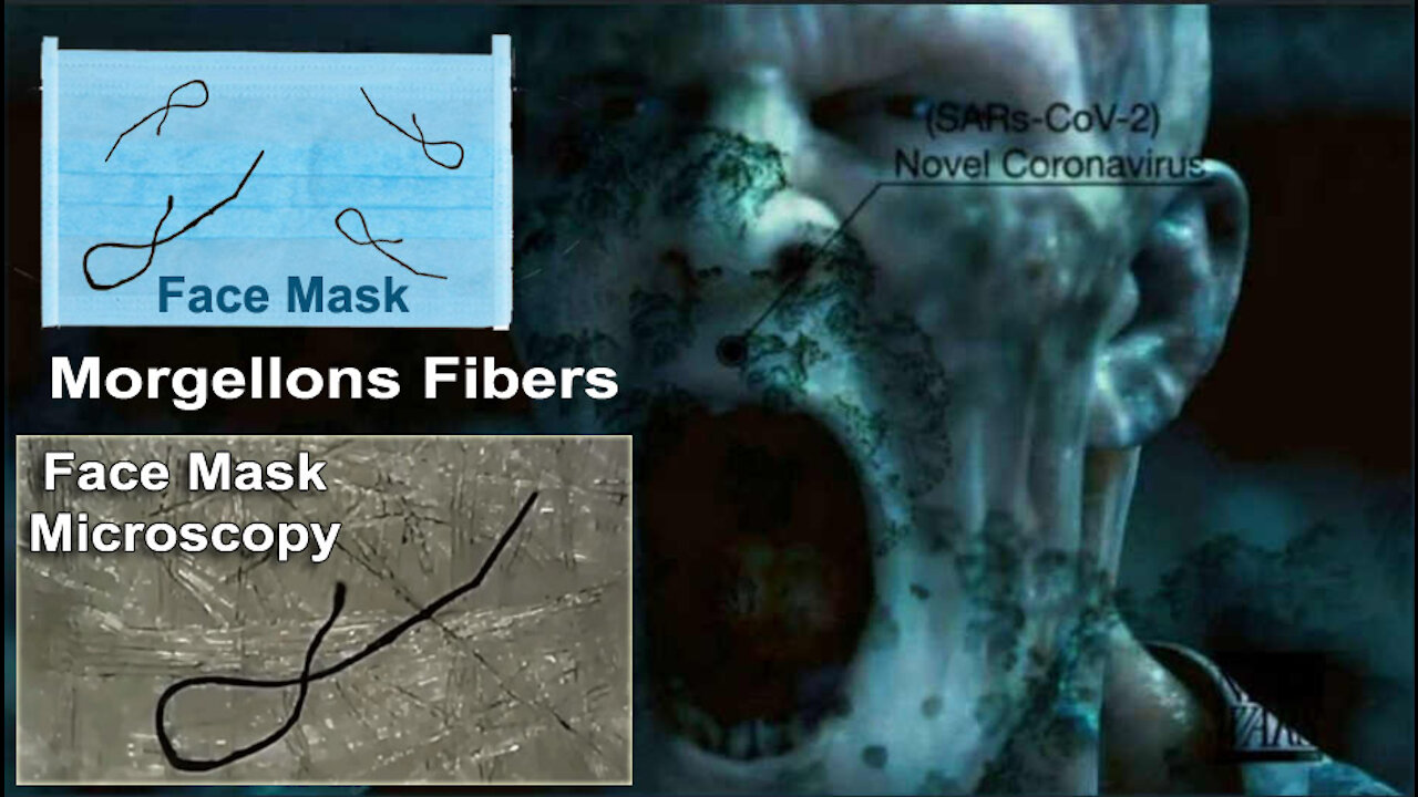 MORGELLONS Discovered in Disposable Face Masks