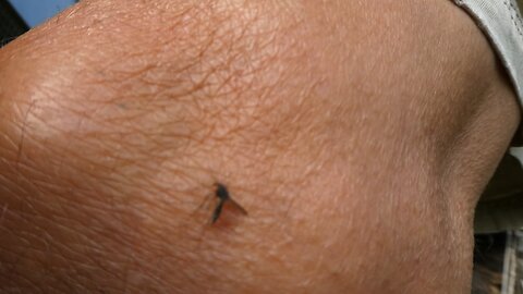 Mosquitoes at their worst