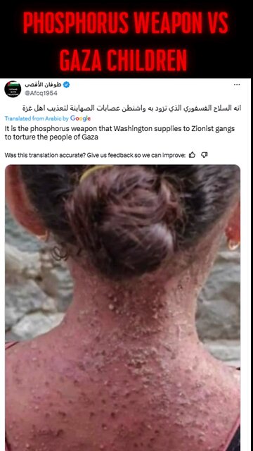 And another Palestinazi lie with stolen pictures. This time from Aman, Yemen.