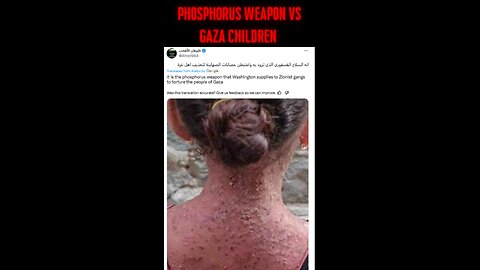 And another Palestinazi lie with stolen pictures. This time from Aman, Yemen.