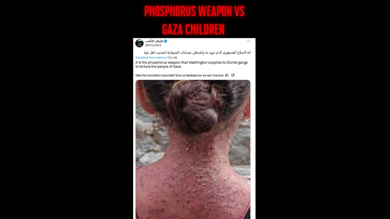 And another Palestinazi lie with stolen pictures. This time from Aman, Yemen.
