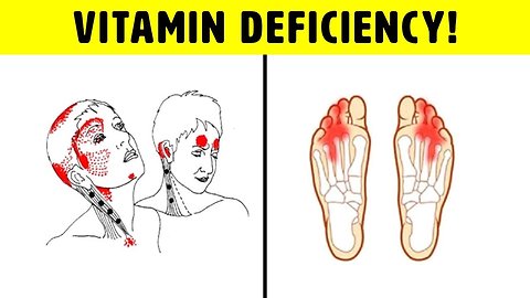 Vitamin B12 Deficiency Symptoms That Should Never Be Ignored