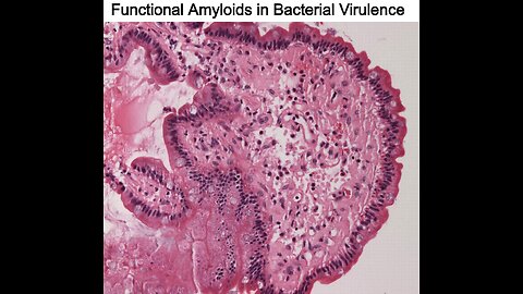 Functional Amyloids in Bacterial Virulence
