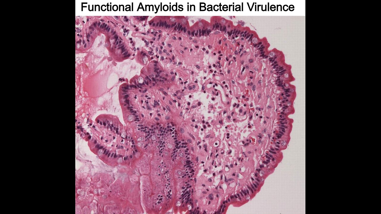 Functional Amyloids in Bacterial Virulence