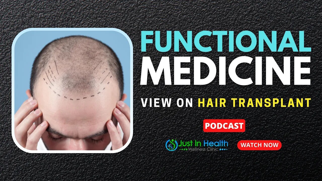 Functional Medicine View on Hair Transplant