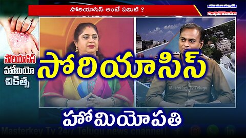 సోరియాసిస్ చికిత్స నివారణ. | డా. భరద్వాజ్ | ఫిడికస్ హోమియోపతి | Treatment and Cure