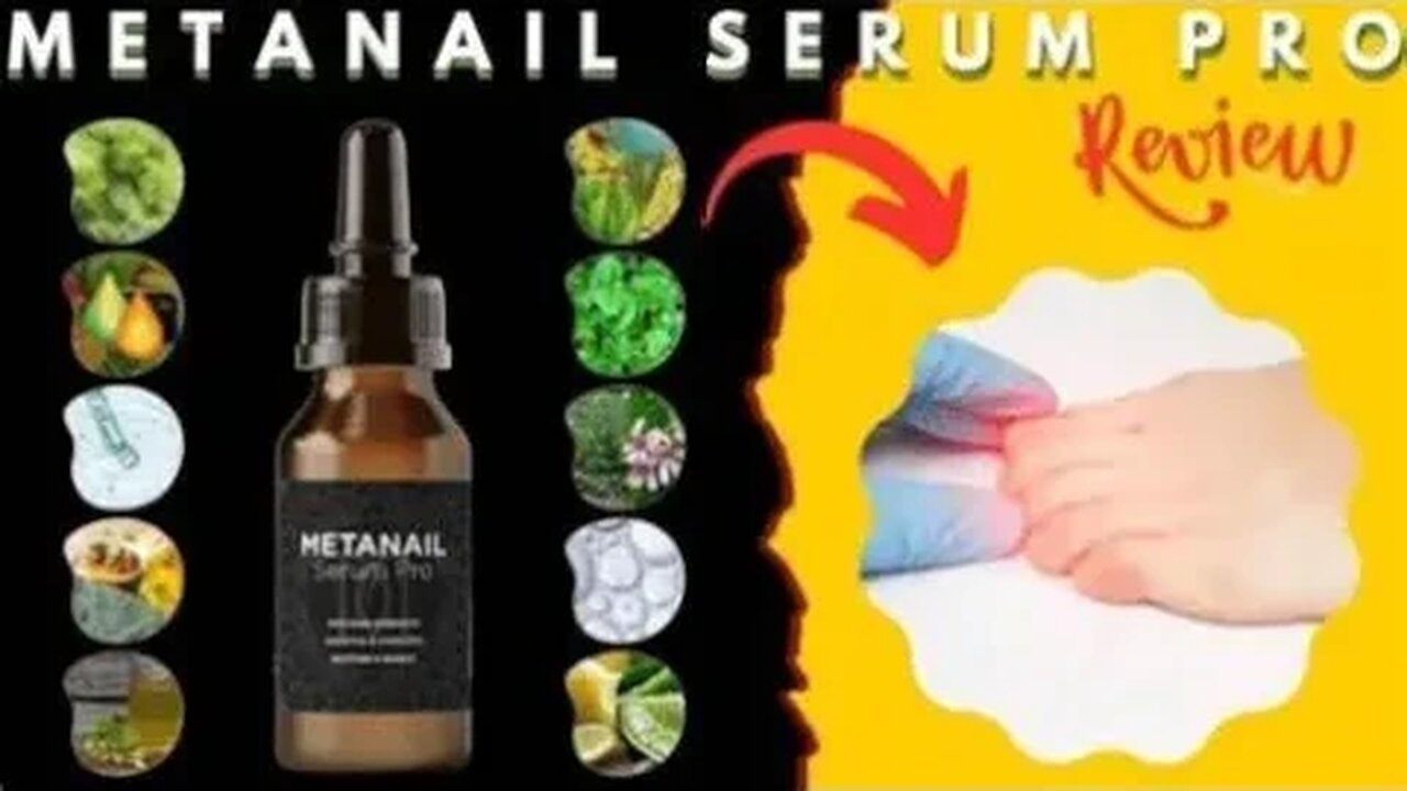 Metanail Healthy Nails & Beautiful Feet. Metanail Complex Review – BEWARE!! – Metanail Complex