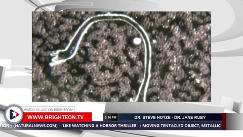 Graphene bubbles caused remotely by frequency cause hemorrhagic fever | NEWS-19