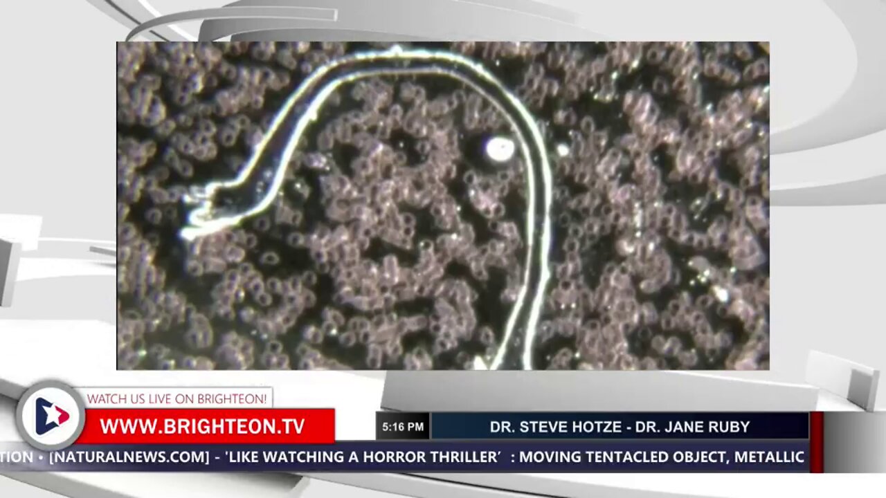Graphene bubbles caused remotely by frequency cause hemorrhagic fever | NEWS-19