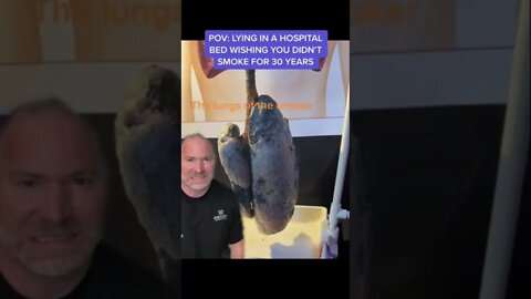 30 Year Old Smoker Lungs 💨 #shorts