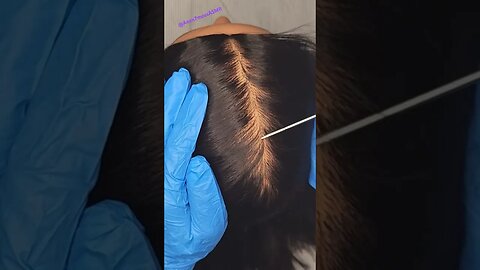 Scalp Massage To Help You Relax 💆🏽‍♀️ 💤~ #notalkingasmr #asmr #asmrsounds #anon7mousasmr