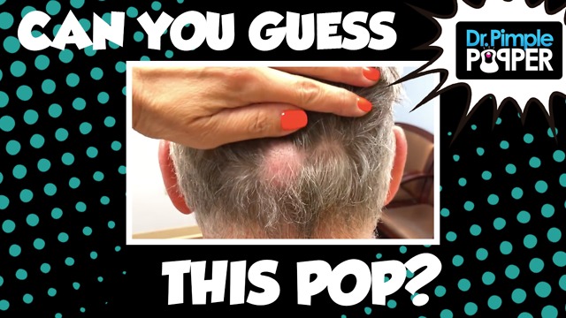 Guess the Derm Diagnosis from Pathology Pops!