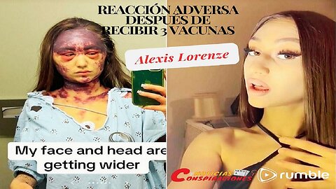 Alexis Lorenze, reacción adversa después de recibir 3 vacunas