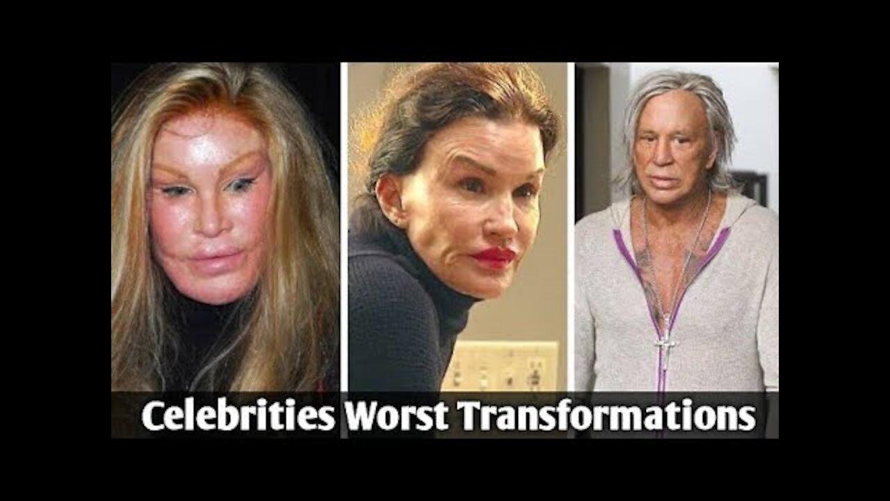 plastics gone wrong on celebrities