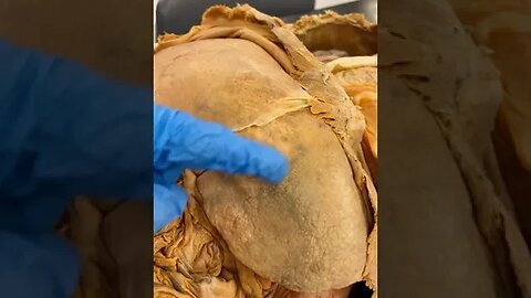 The Liver Regenerates — Why Is There Liver Cancer?