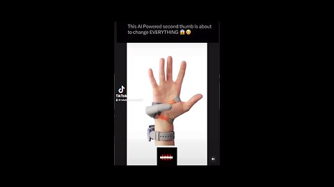 Would You Wear This 2nd Thumb?
