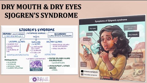 SJOEGREN SYNDROME (DRY MOUTH AND EYES) | True Pathfinder
