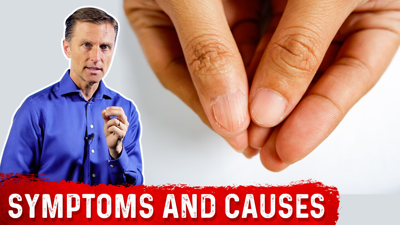 Iron Deficiency Anemia Symptoms and Causes