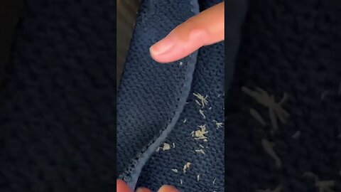 Skin Picking Tiktok ocdnailcuticles