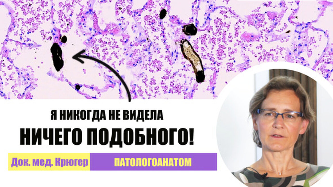 «Я никогда не видела ничего подобного!». Доктор медицины Уте Крюгер шведский патологоанатом