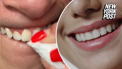 I'm a dentist — here's the reason you should never use whitening toothpaste