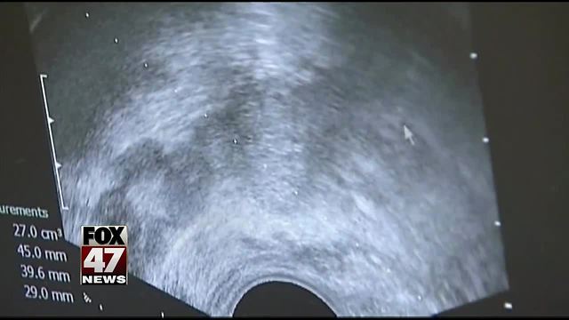 Many breast cancer patients can skip chemo, big study finds