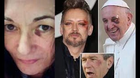 Ghislaine Maxwell Joins the ‘Illuminati’ Left Black Eye Club! Doesn't Know How She Got It!
