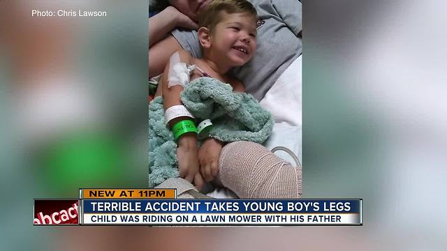 Toddler who lost both legs in tractor accident released from Tampa General