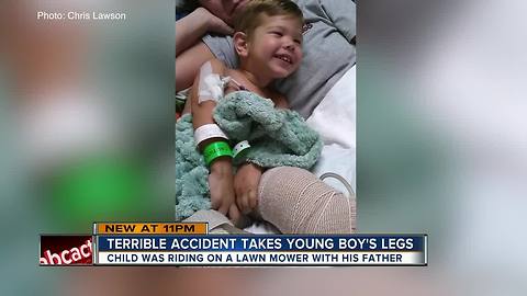 Toddler who lost both legs in tractor accident released from Tampa General