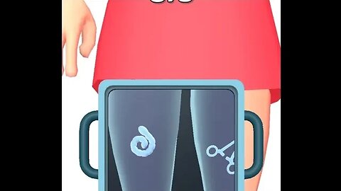 errr ... worm 🐛 parasite cleaned at body -- FRANSISCA SIM