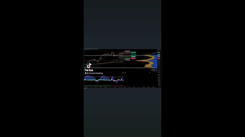 $EURUSD | 1H Trade Setup Update Position: 🟢 Long