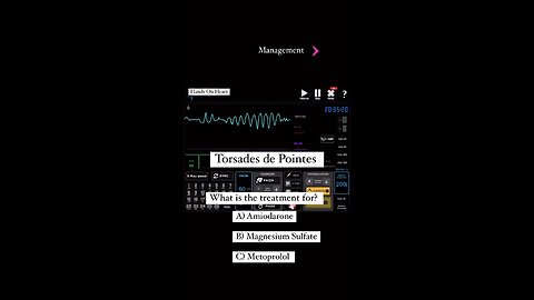 Torsades de point ECG rhythm