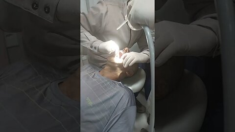 Colocação de pino, para implante dentário!
