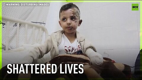 Heartbreaking | Gaza-Israel conflict leave hundreds of children with amputated limbs