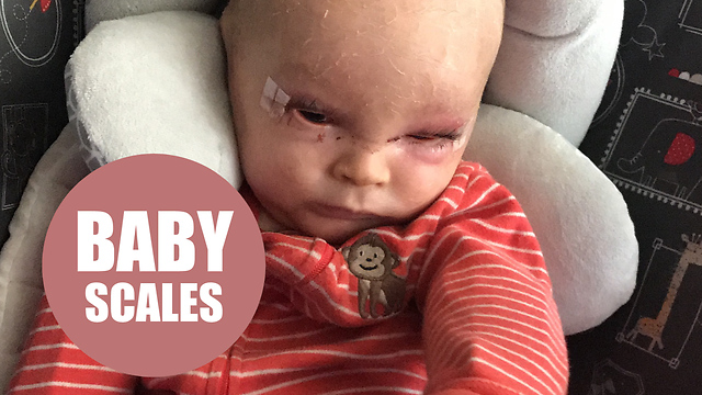 Boy with condition that makes skin scale like a fish finally finds relief with cannabis oil