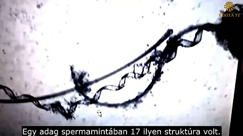 Dr. Young Mi Lee - Dél-Koreai kutatócsoport nanorobotokat talált a spermában 2 évvel a vakcina után