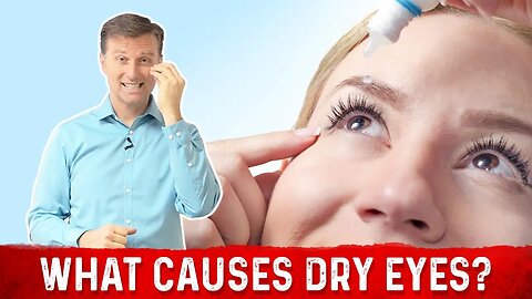 Vitamin A Deficiency – Causes of Dry Eyes Explained by Dr. Berg