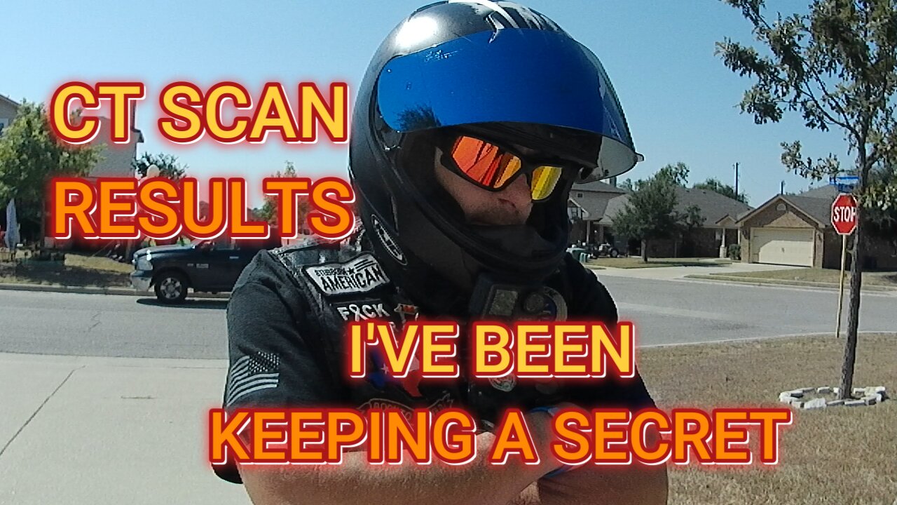 YOU ARE NOT GOING TO BELIEVE THIS!