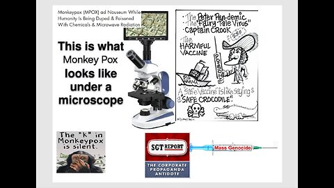 WW3 Update: MONEY POX $$$: WHO DECLARES GLOBAL HEALTH EMERGENCY -- Dr. Robert Young 1h