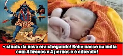 + sinais da nova era chegando! Bebe nasce na índia com 4 braços e 4 pernas e é adorado!
