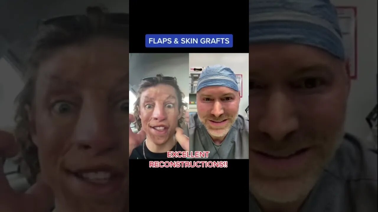 Getting Plastic Surgery All Over Your Face 😂 #shorts