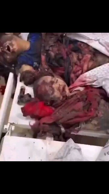 Yahya Sinwar fought against the people doing this 2 children.If you r against him ⏬⏬Read description